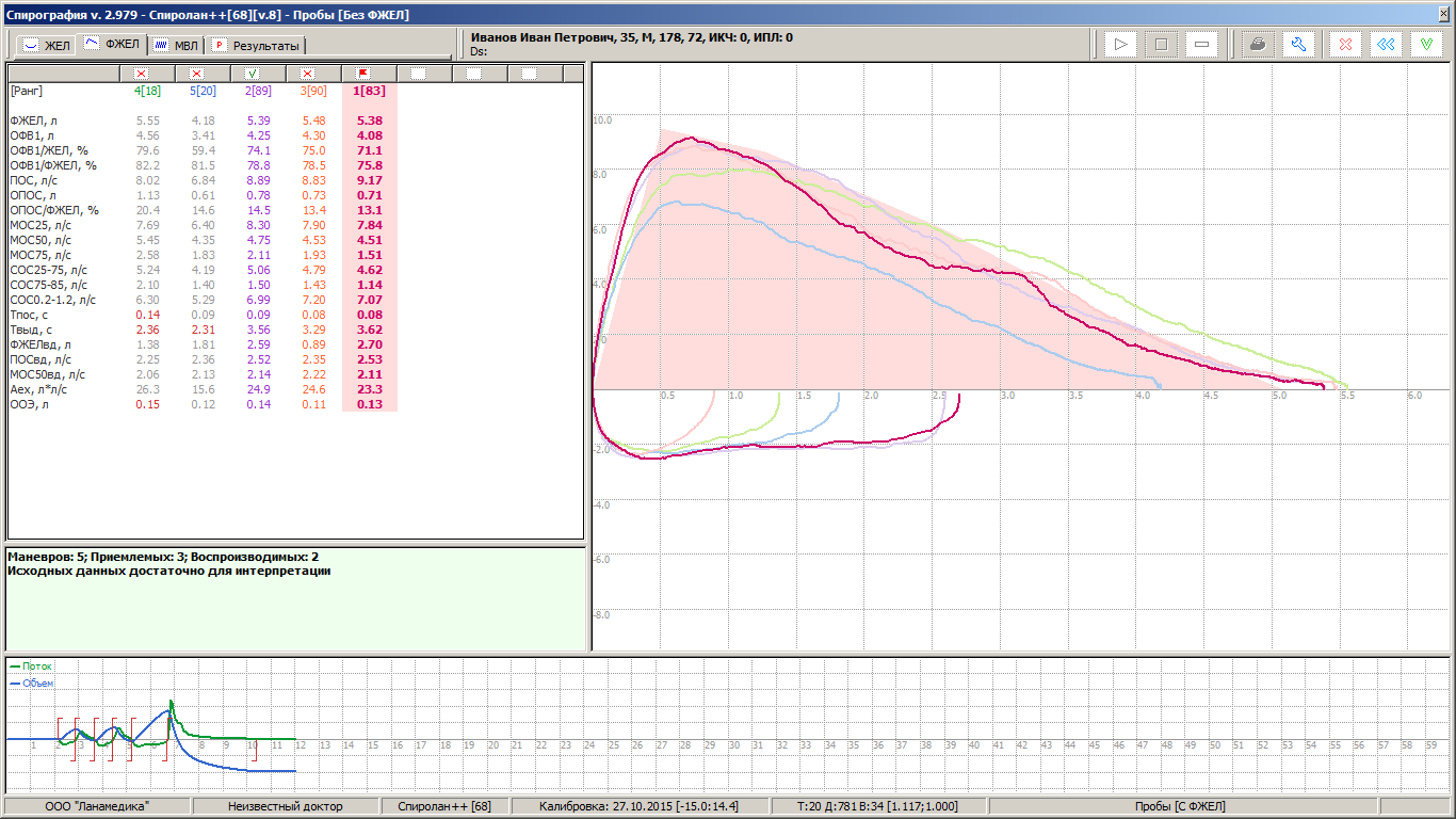 Результаты спирографии